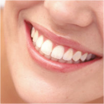 Pleasanton Teeth Whitening